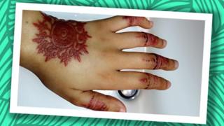 Mano cicatrizada con marcas de henna